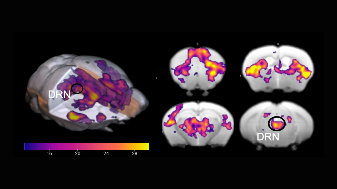 Serotonin activates the brain