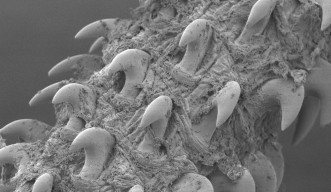 SEM photo showing barbed hooks on a fleshy tentacle.
