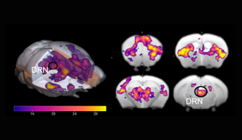 Serotonin activates the brain